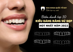 Top 10 dáng răng sứ đẹp được ưa chuộng nhất hiện nay